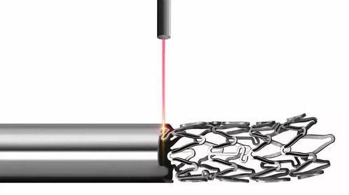 国产火鹰支架视频,创新引领心血管介入治疗新篇章  第1张